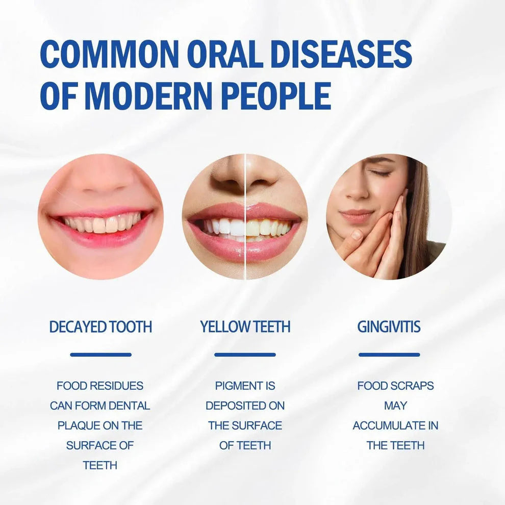 ✨SP-4 Probiotic Brightening & Stain Removing Toothpaste 🦷